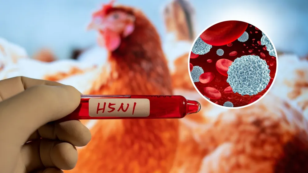 Bird Flu Rise: Study Suggests Pre-existing Immunity May Provide Protection