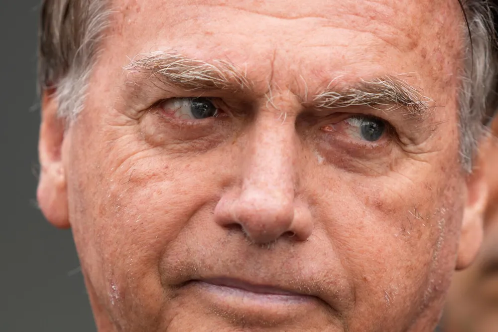 Brazil's ex-President Jair Bolsonaro hospitalized in ICU with bronchopneumonia