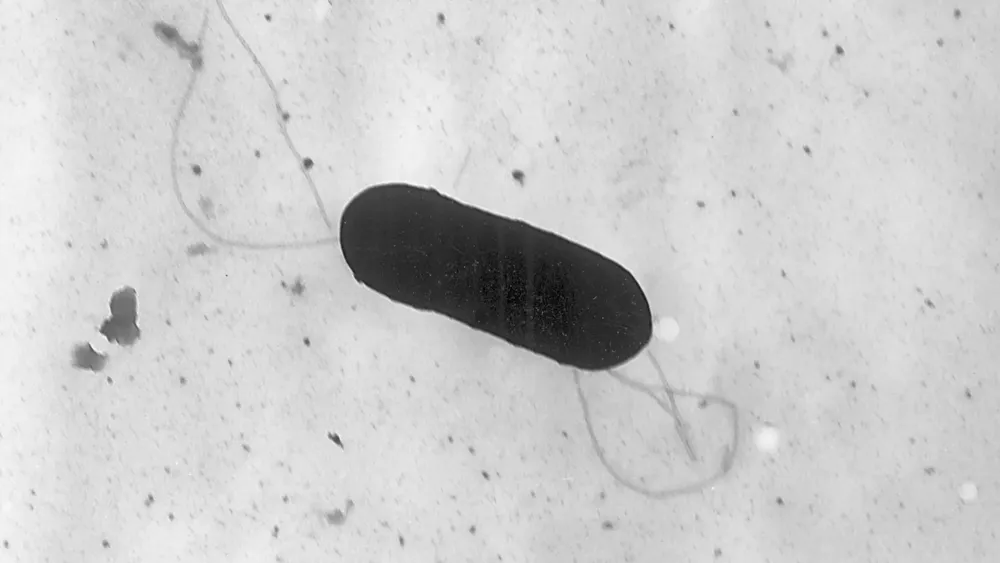 L.A. Company Recalls Food Products Amid Listeria Outbreak Affecting Ten Individuals