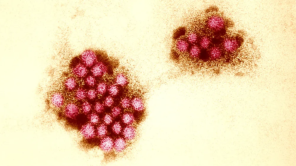 Can Vaccines Overcome Genetic Resistance to Norovirus?