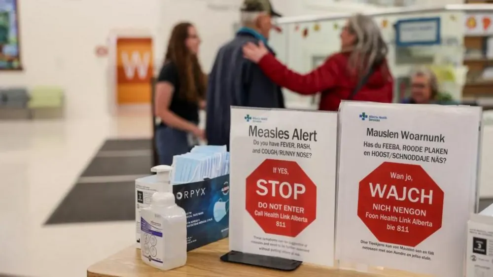 Canada Loses Measles Elimination Status Amid Ongoing Outbreaks, U.S. at Risk