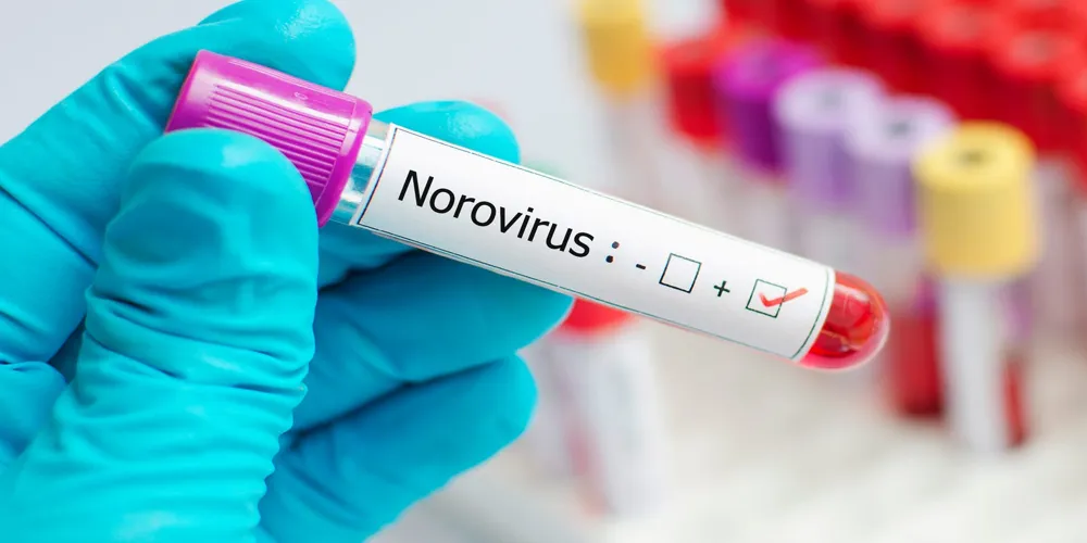 Surge in Norovirus Cases Across the U.S.: What You Need to Know