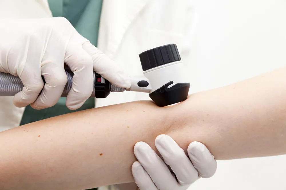 Essential Guide on What to Expect During a Skin Cancer Screening