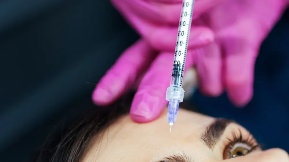 Essential Guide to Botox and Fillers: What You Need to Know Before Getting Started