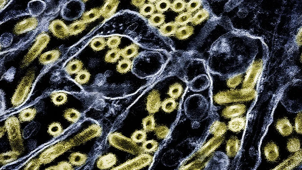 First confirmed human death from H5N5 bird flu reported in Washington State