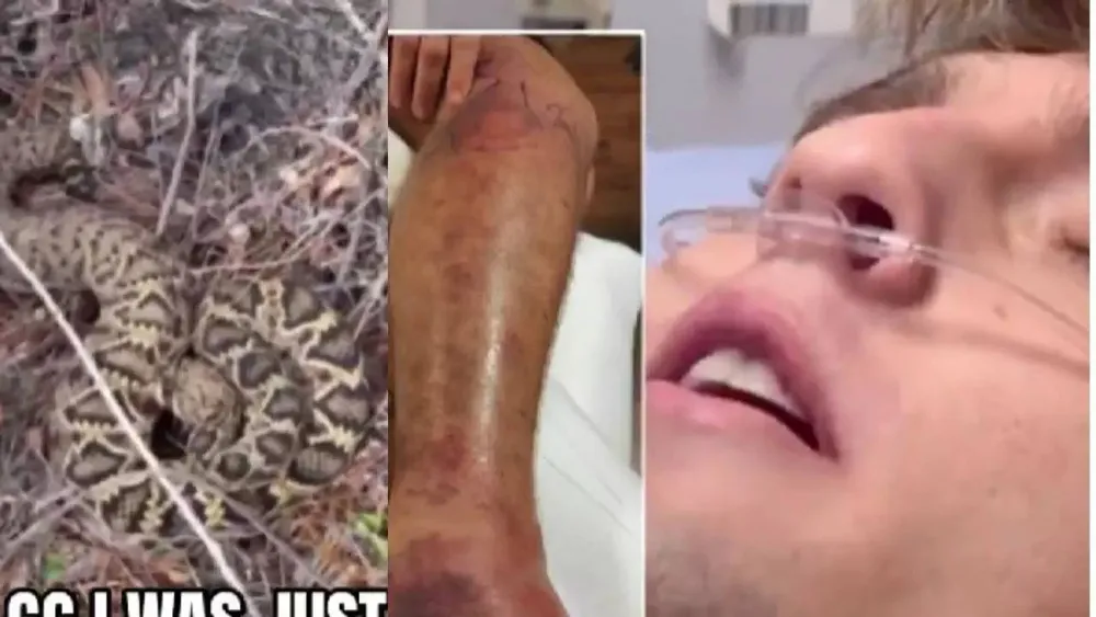 Florida influencer's calm demeanor following snake bite raises concerns over wildlife content creation