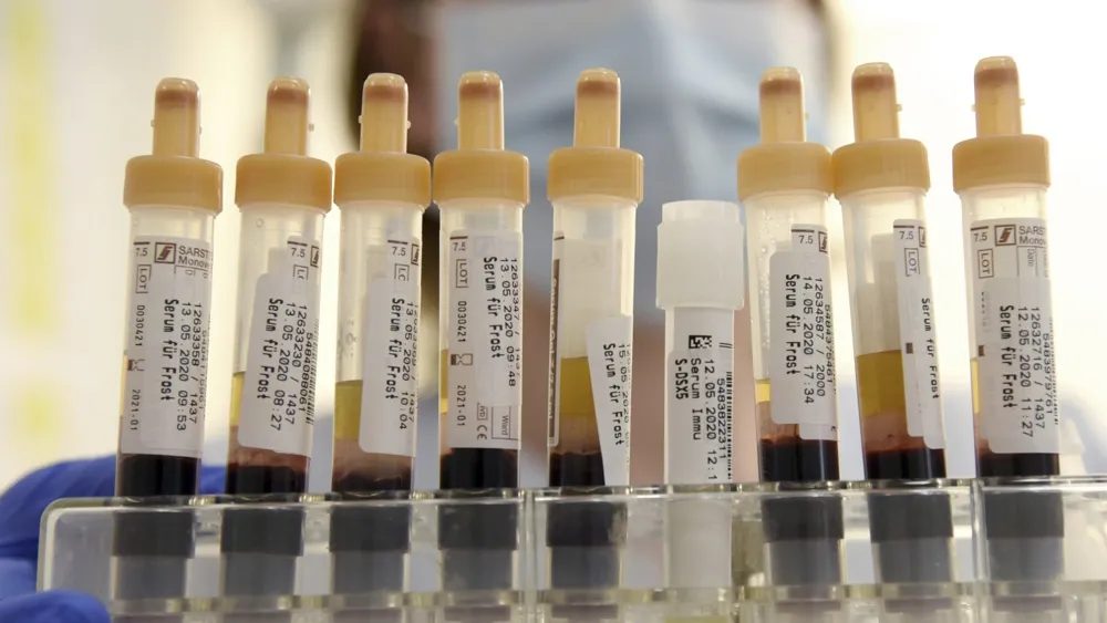 French Scientists Identify Unique Blood Type 'Gwada Negative' in Caribbean Woman