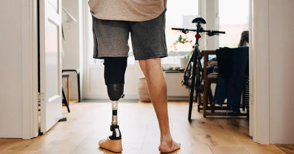 Insurers Question Medical Necessity of Prosthetic Limbs, Limiting Coverage