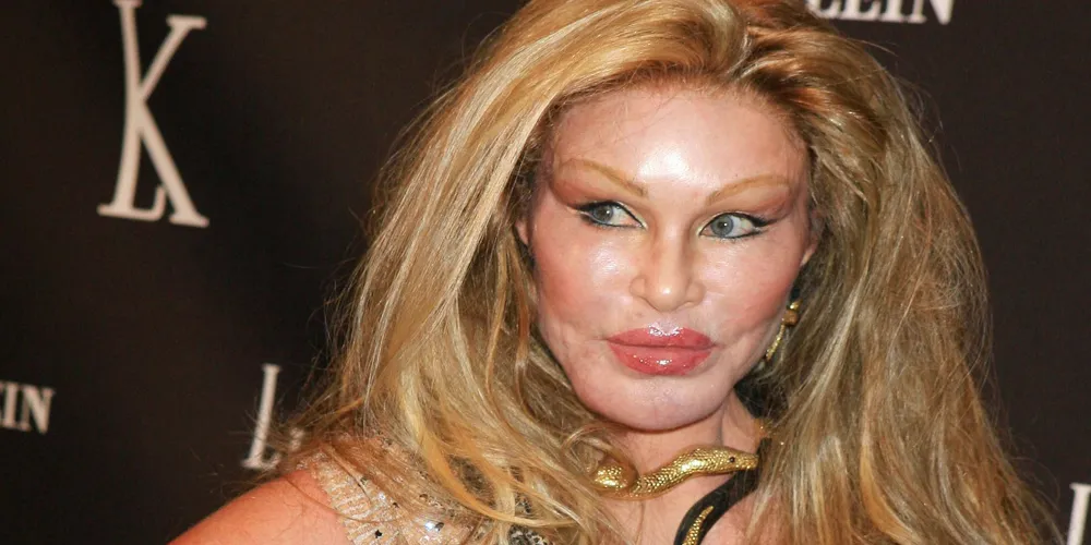 Jocelyn Wildenstein, Iconic 'Catwoman,' Passes Away at 84: Cause of Death Revealed