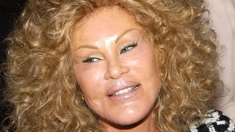 Jocelyne Wildenstein, Notorious Socialite and 'Catwoman,' Passes Away at 79