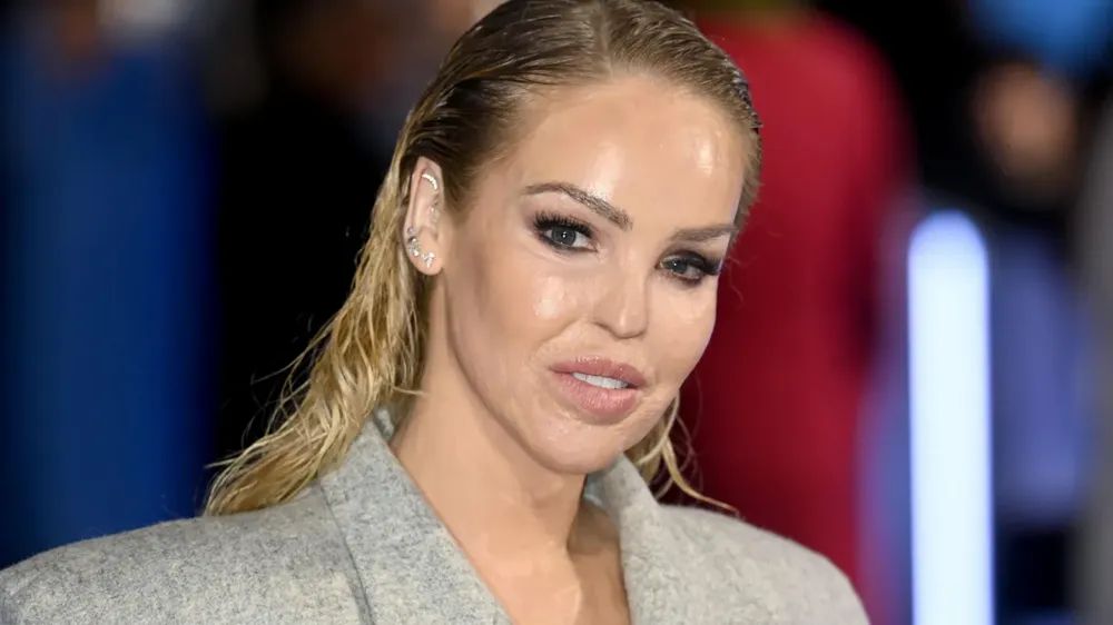 Katie Piper to Receive Prosthetic Eye After 16-Year Recovery from Acid Attack