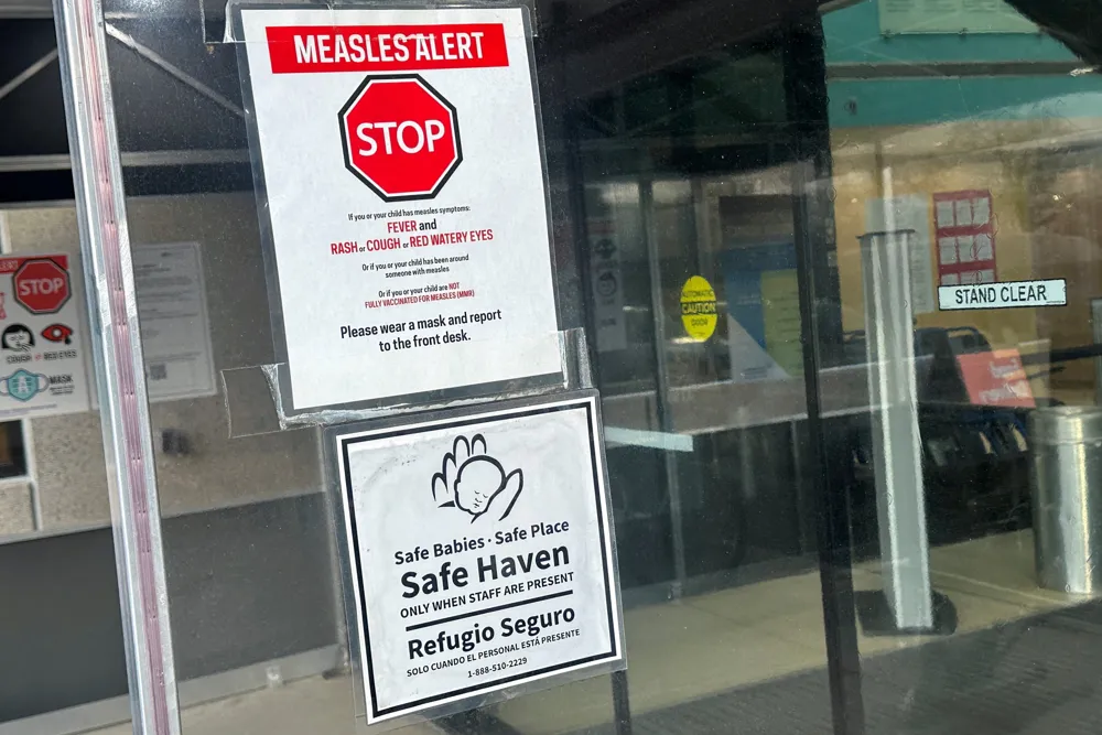 Measles Cases Surge in the U.S., Major Outbreaks Centered in Texas