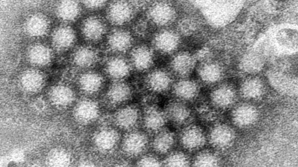 New Norovirus Strain Raises Public Health Concerns Amid Rising Outbreaks