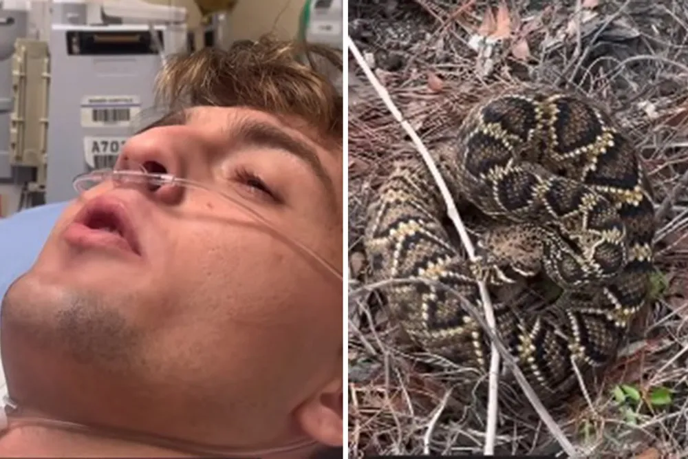 Social media influencer hospitalized after fatal rattlesnake bite in Florida