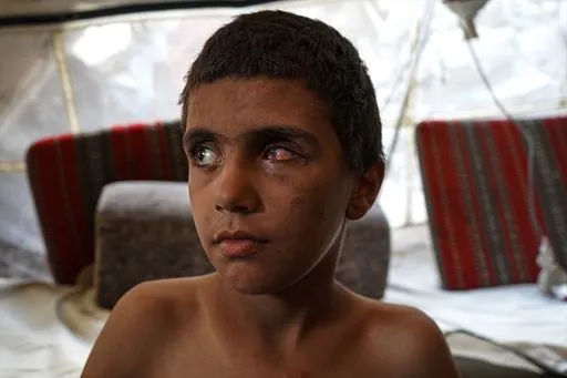 UN Reports 21,000 Children Disabled in Gaza Due to Ongoing Conflict