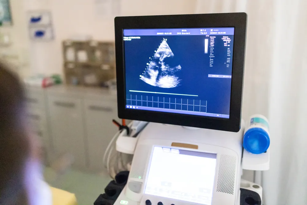 Understanding the Diagnosis of Hypertrophic Cardiomyopathy