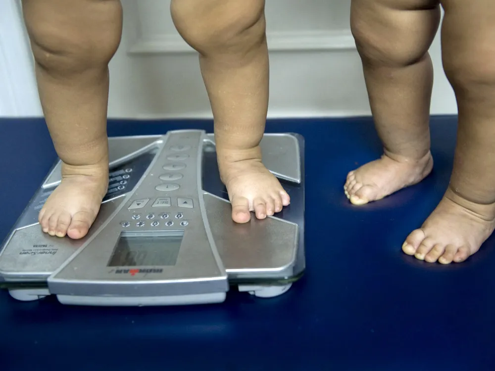 UNICEF Reports Obesity Now Outnumbers Underweight in Children Worldwide